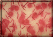 GRAM STAIN OF ANTHRAX